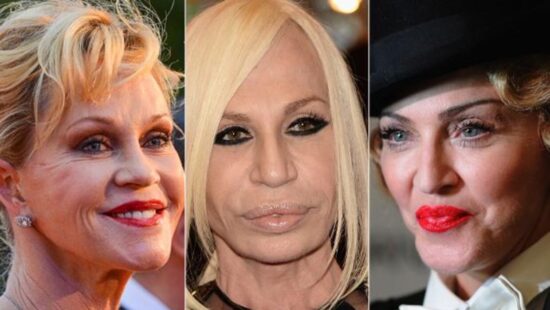 Qué es la violencia estética y cómo afecta a las mujeres 2 Famosas antes y después del botox