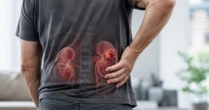 Dolor en un lado de la espalda baja s&iacute;ntomas de cancer de ri&ntilde;on